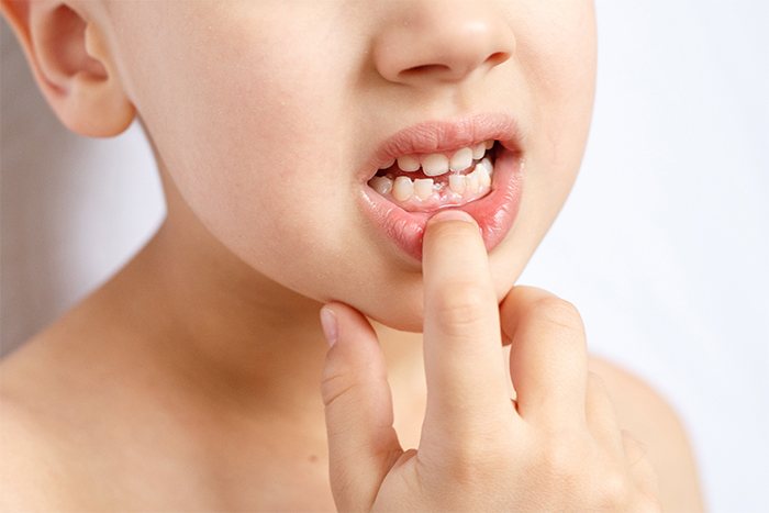 Breaking the Nail-Biting Habit: A Guide to Protecting Your Child’s Oral Health