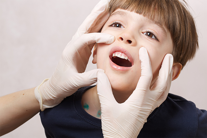 6 Year Molars | Kenmore, WA | Kenmore Pediatric Dentistry