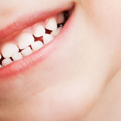 how-to-care-for-your-childs-teeth-banner