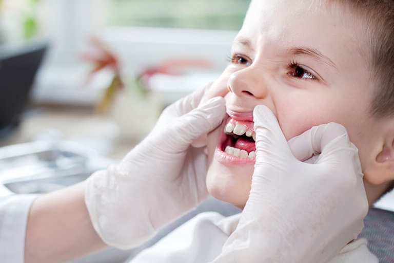 What Shark Teeth Means for a Child's Oral Health | Kenmore, WA