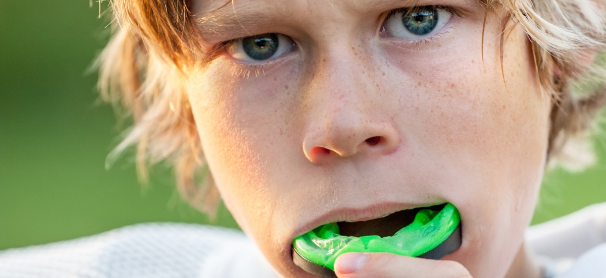 Should My Child Wear a Mouthguard? Protecting Your Child’s Teeth