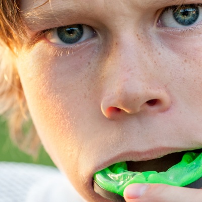 should-my-child-wear-a-mouthguard-protecting-your-childs-teeth-banner